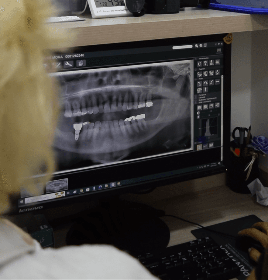 Panoramic dental X-ray displayed on a diagnostic screen